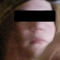 Крісбанекс Оголені