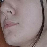 мар.децурнекс Оголені