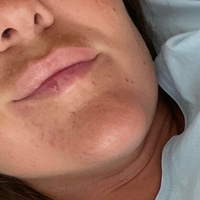 озорна катерина фрі Оголені